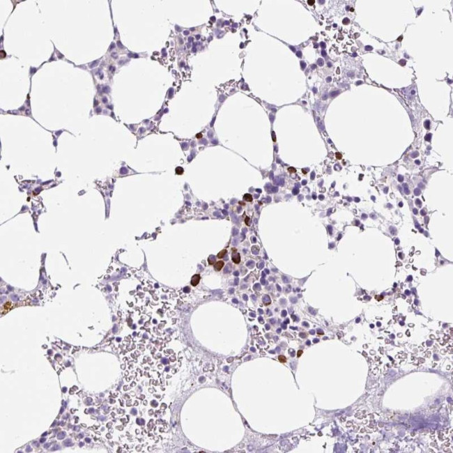 RNF212B Antibody in Immunohistochemistry (Paraffin) (IHC (P))