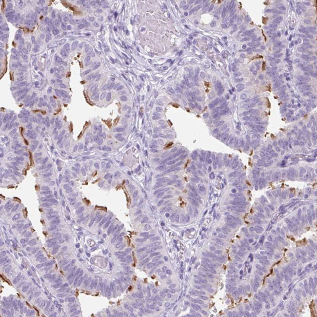 TMEM89 Antibody in Immunohistochemistry (Paraffin) (IHC (P))