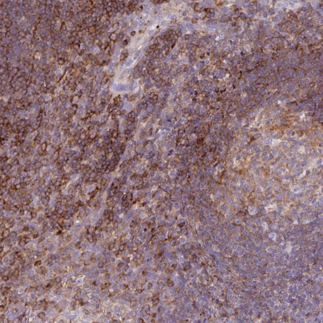 Coronin 7 Antibody in Immunohistochemistry (IHC)