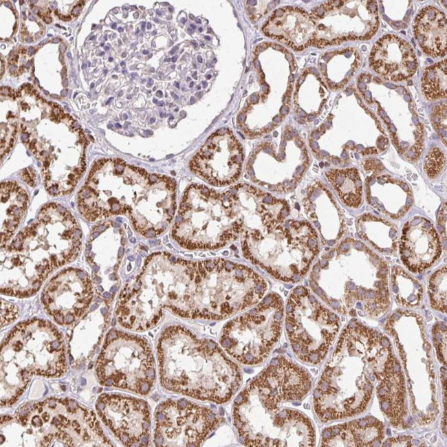 SGF29 Antibody in Immunohistochemistry (Paraffin) (IHC (P))