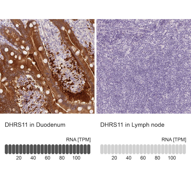 DHRS11 Antibody in Immunohistochemistry (IHC)
