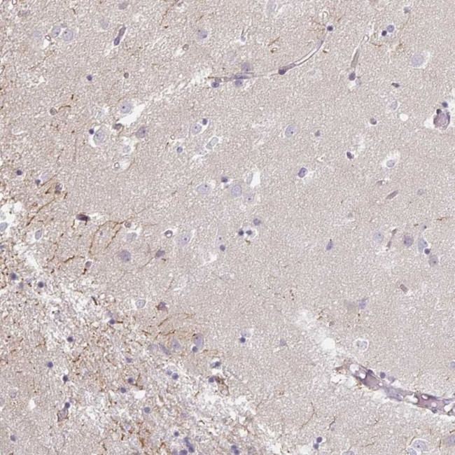 IP6K3 Antibody in Immunohistochemistry (IHC)