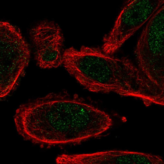 CYHR1 Antibody in Immunocytochemistry (ICC/IF)