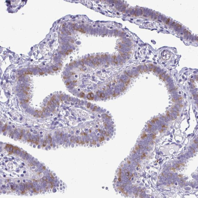 SPAG1 Antibody in Immunohistochemistry (Paraffin) (IHC (P))