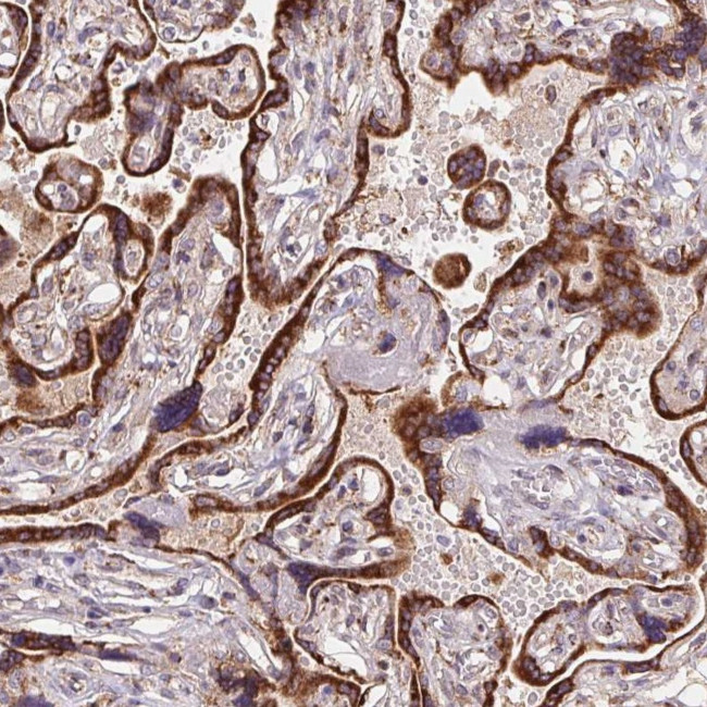 KLHL20 Antibody in Immunohistochemistry (Paraffin) (IHC (P))