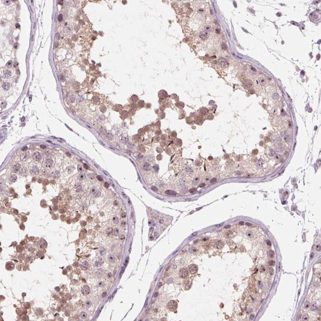 TDIF2 Antibody in Immunohistochemistry (Paraffin) (IHC (P))
