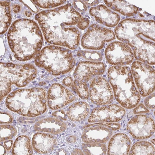 DLEU7 Antibody in Immunohistochemistry (Paraffin) (IHC (P))