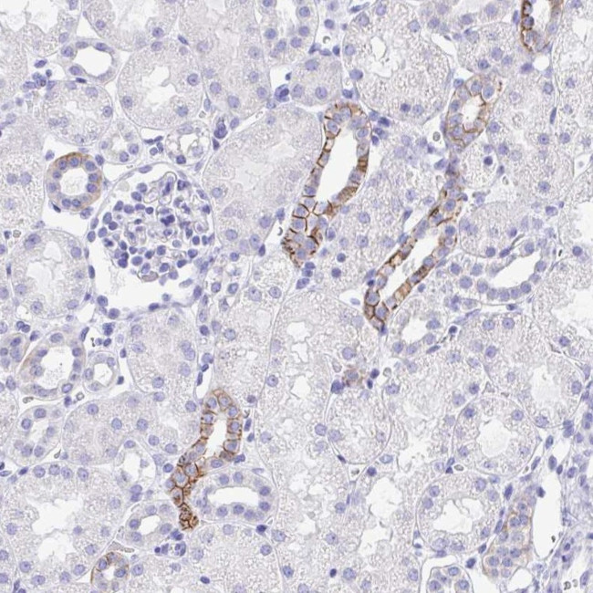 MON1A Antibody in Immunohistochemistry (Paraffin) (IHC (P))