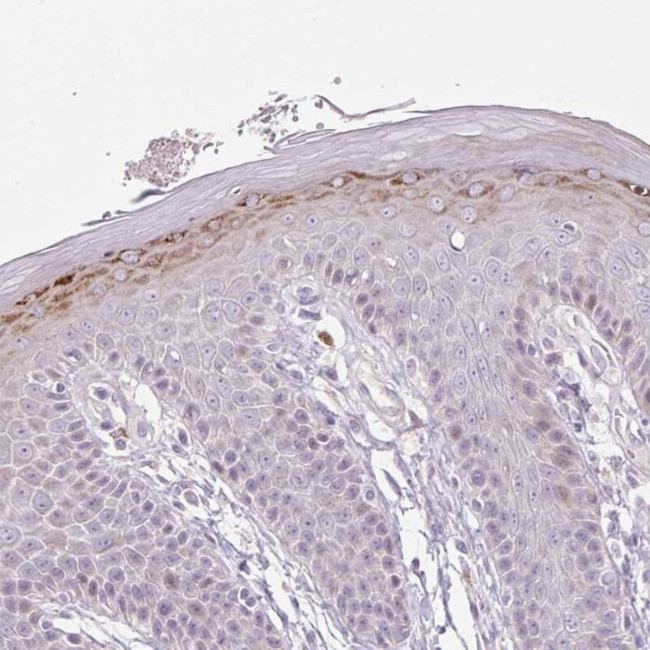 ZNF814 Antibody in Immunohistochemistry (IHC)