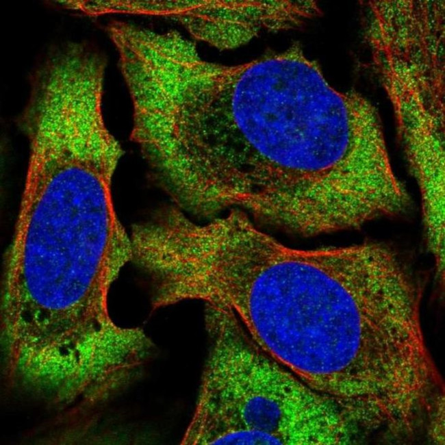 ATP6AP1L Antibody in Immunocytochemistry (ICC/IF)