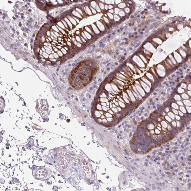 ADAMTSL2 Antibody in Immunohistochemistry (Paraffin) (IHC (P))