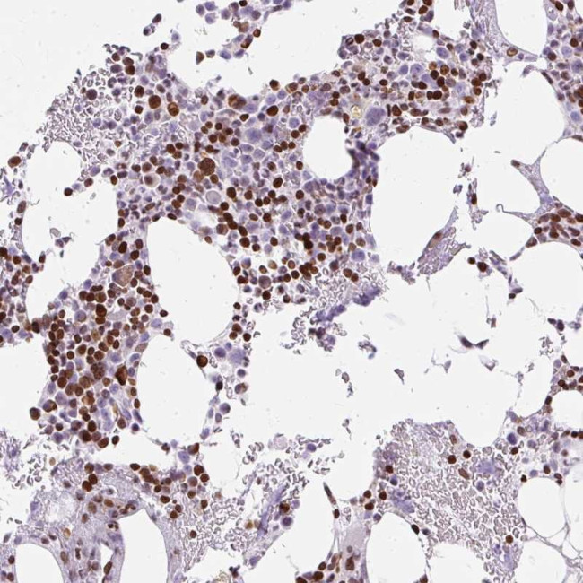 TMEM177 Antibody in Immunohistochemistry (Paraffin) (IHC (P))
