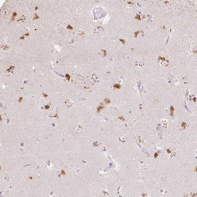 Clavesin-1 Antibody in Immunohistochemistry (Paraffin) (IHC (P))