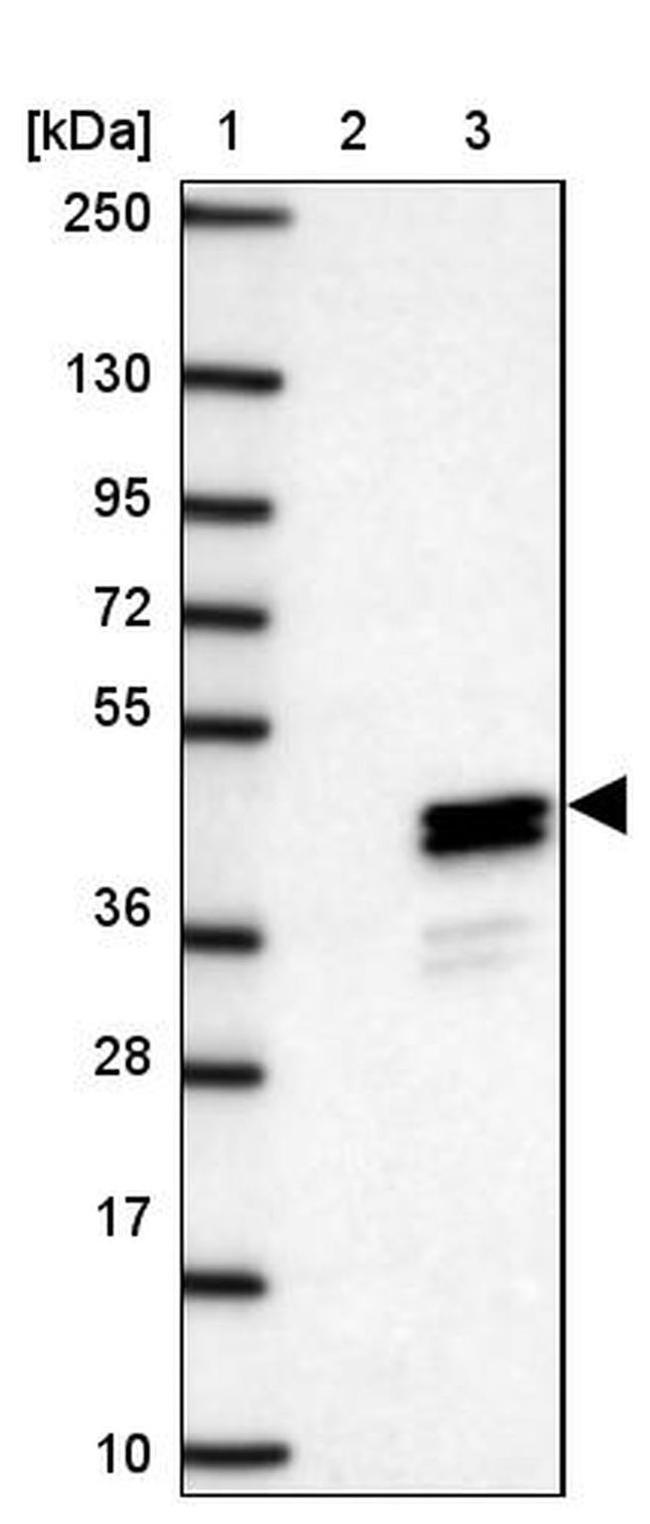 Clavesin-1 Antibody in Western Blot (WB)