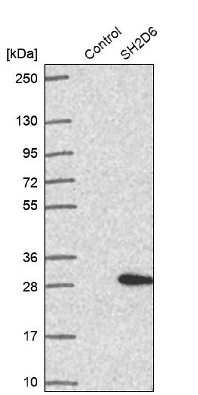 SH2D6 Antibody in Western Blot (WB)