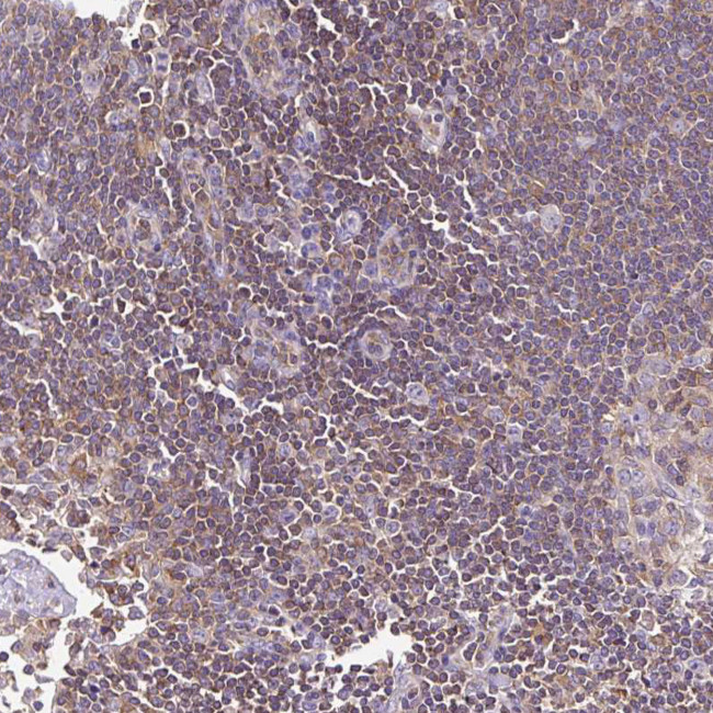TWF2 Antibody in Immunohistochemistry (Paraffin) (IHC (P))