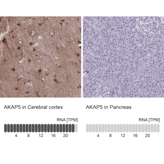 AKAP5 Antibody in Immunohistochemistry (IHC)