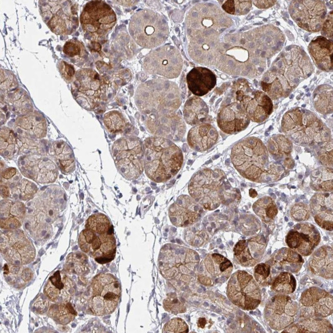 TMCC1 Antibody in Immunohistochemistry (Paraffin) (IHC (P))