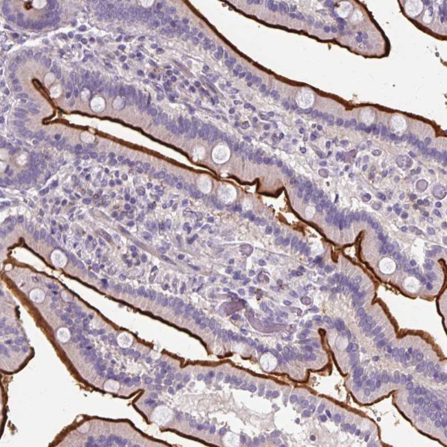 ZNF648 Antibody in Immunohistochemistry (Paraffin) (IHC (P))