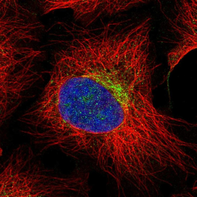 Hemicentin 2 Antibody in Immunocytochemistry (ICC/IF)