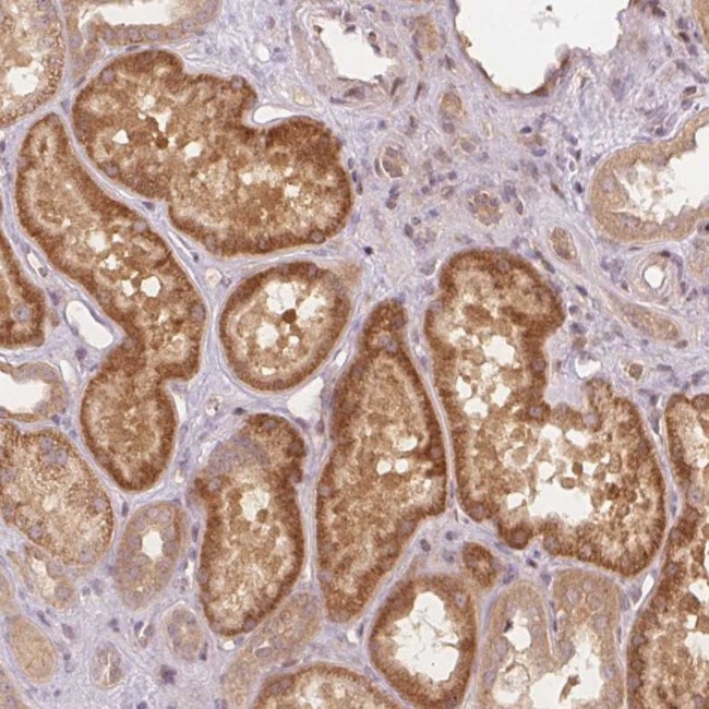 PCDHB1 Antibody in Immunohistochemistry (Paraffin) (IHC (P))