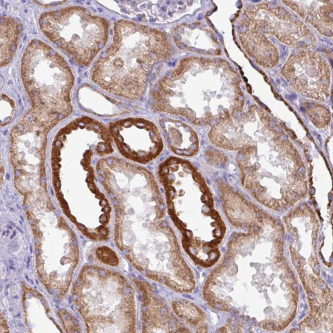 MT-ND4 Antibody in Immunohistochemistry (IHC)