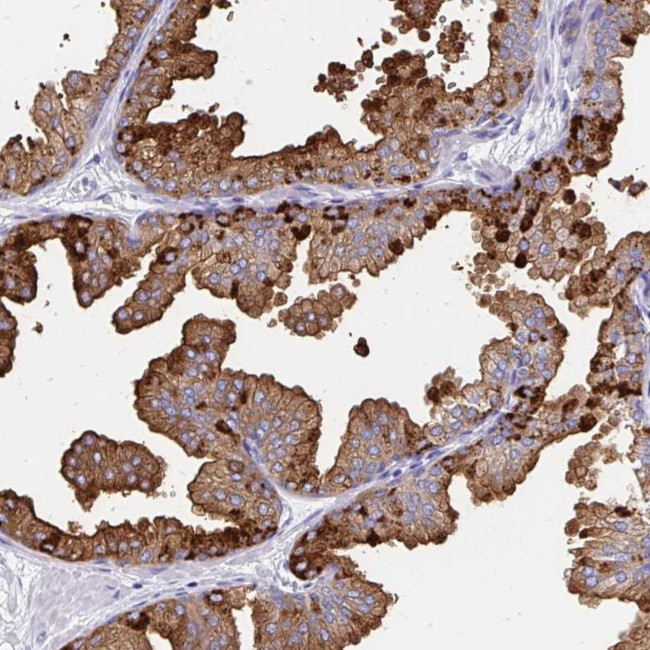 TEKT4 Antibody in Immunohistochemistry (Paraffin) (IHC (P))