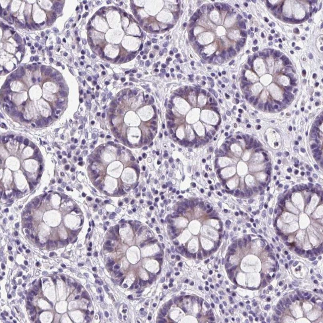 ZNF555 Antibody in Immunohistochemistry (IHC)