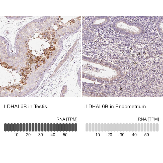 LDHAL6B Antibody in Immunohistochemistry (IHC)