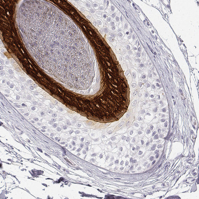 KRT25 Antibody in Immunohistochemistry (IHC)