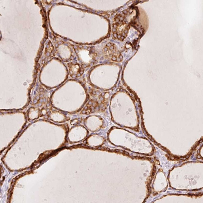 OR13C3 Antibody in Immunohistochemistry (Paraffin) (IHC (P))