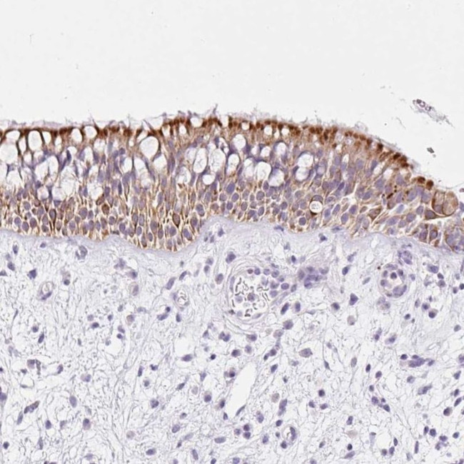 COP1 Antibody in Immunohistochemistry (IHC)