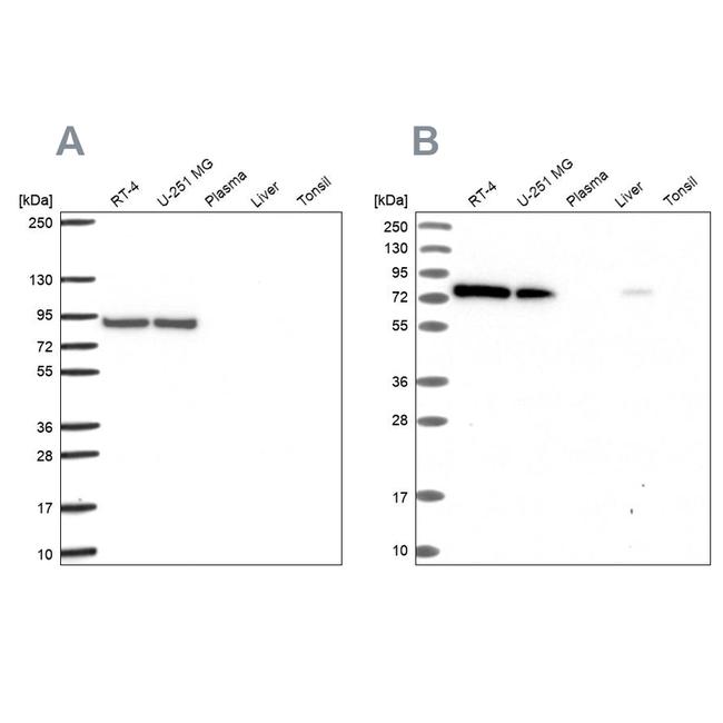 DYNC1I2 Antibody in Western Blot (WB)