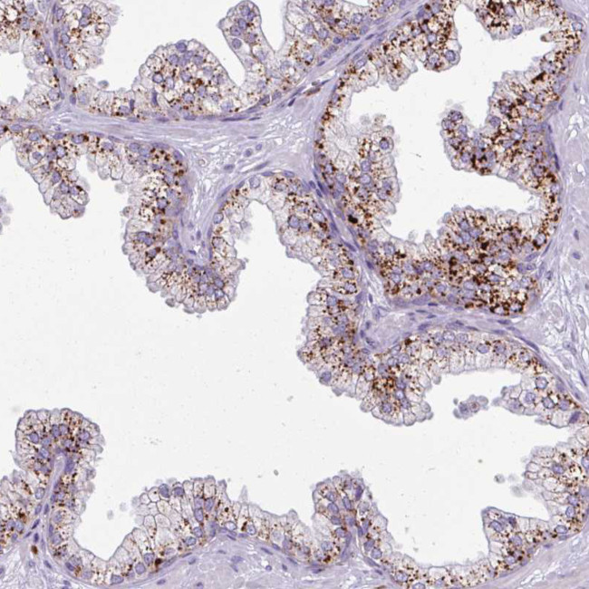 Alivin 1 Antibody in Immunohistochemistry (Paraffin) (IHC (P))