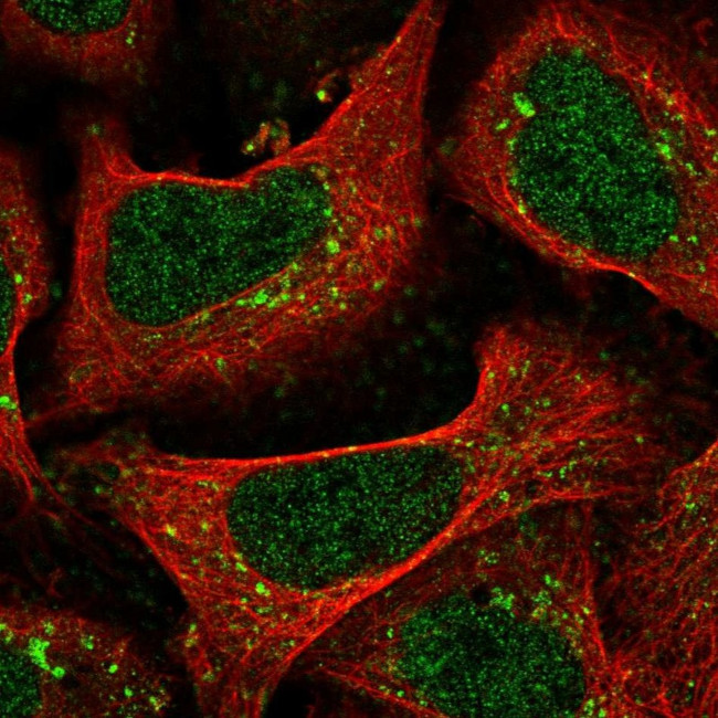 TMEM184C Antibody in Immunocytochemistry (ICC/IF)