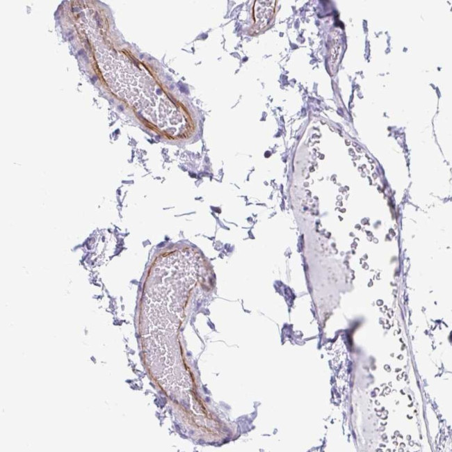 EML5 Antibody in Immunohistochemistry (Paraffin) (IHC (P))