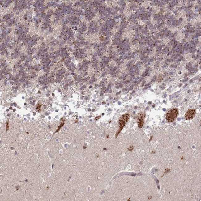 TMEM246 Antibody in Immunohistochemistry (IHC)