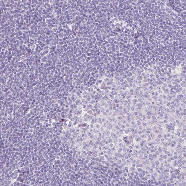TMEM213 Antibody in Immunohistochemistry (Paraffin) (IHC (P))