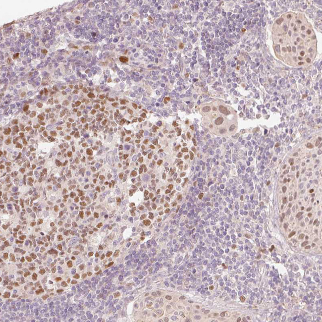 TREX2 Antibody in Immunohistochemistry (Paraffin) (IHC (P))