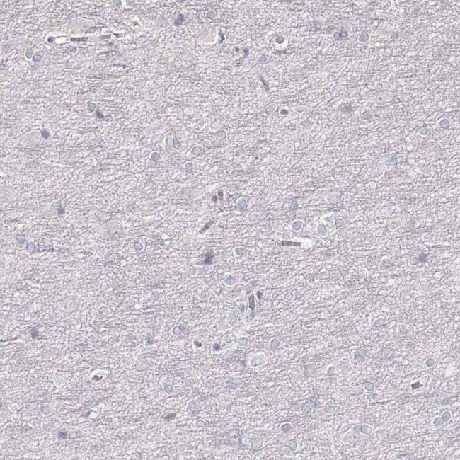 ZP3 Antibody in Immunohistochemistry (Paraffin) (IHC (P))