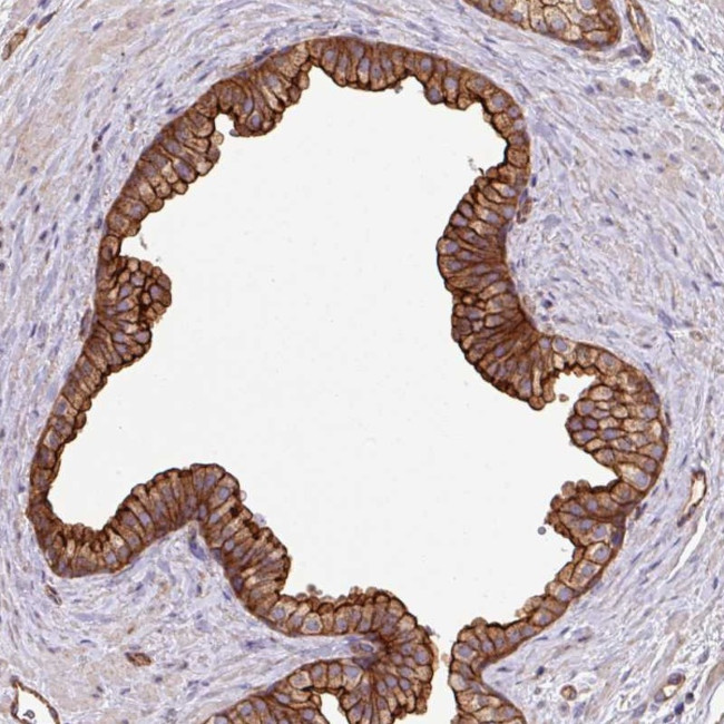 LRRC53 Antibody in Immunohistochemistry (Paraffin) (IHC (P))