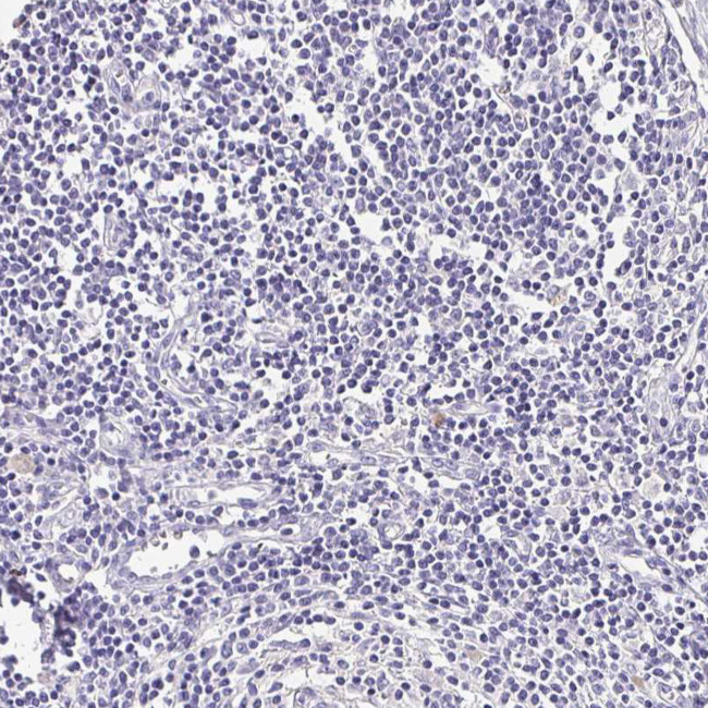 UGT1A6 Antibody in Immunohistochemistry (Paraffin) (IHC (P))