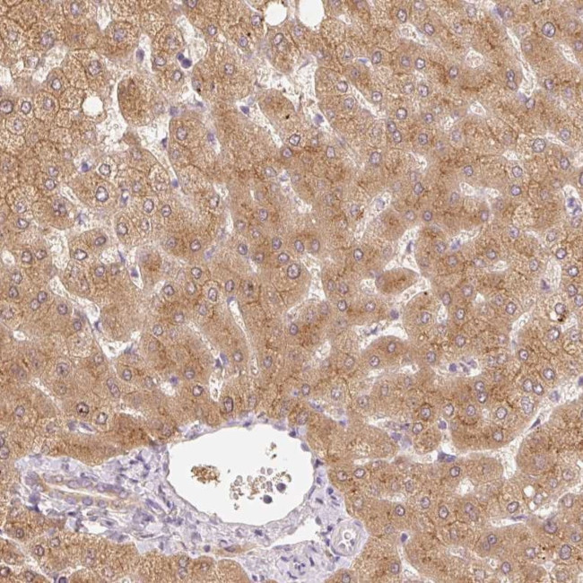CTAGE5 Antibody in Immunohistochemistry (Paraffin) (IHC (P))