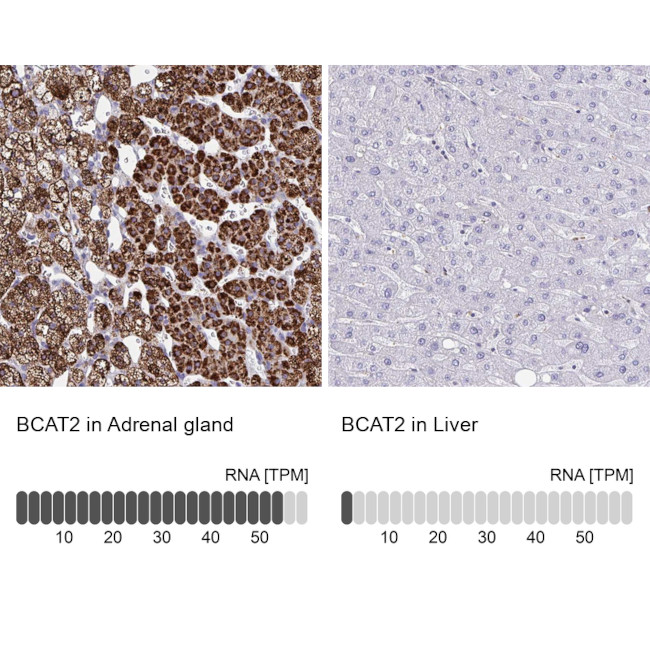 BCAT2 Antibody in Immunohistochemistry (IHC)