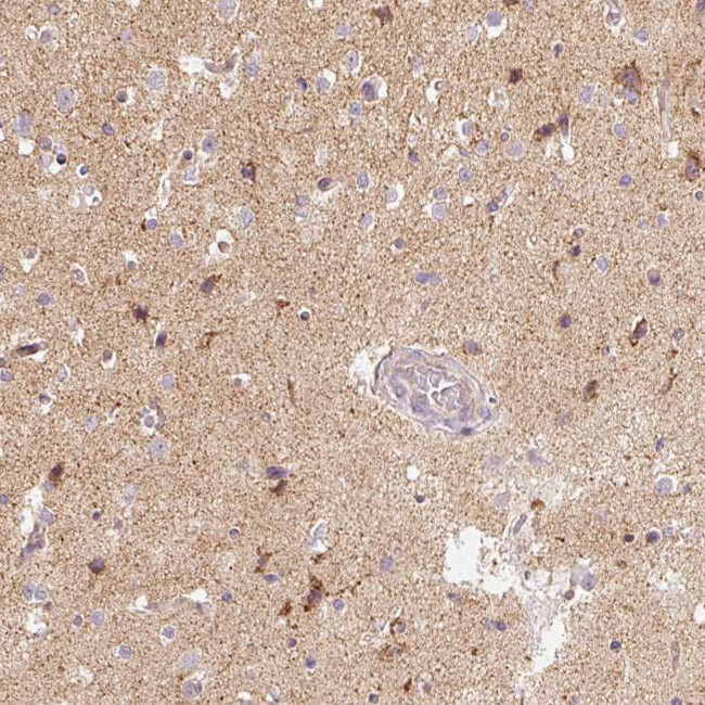 TOB2 Antibody in Immunohistochemistry (Paraffin) (IHC (P))