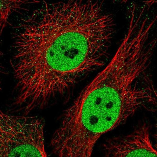 TLE3 Antibody in Immunocytochemistry (ICC/IF)