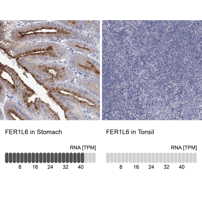 FER1L6 Antibody in Immunohistochemistry (Paraffin) (IHC (P))