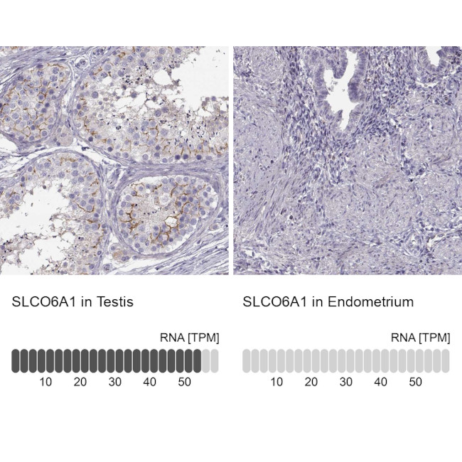 SLCO6A1 Antibody