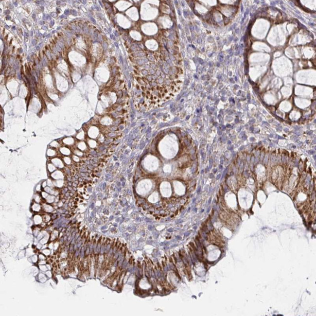 RNF144B Antibody in Immunohistochemistry (Paraffin) (IHC (P))