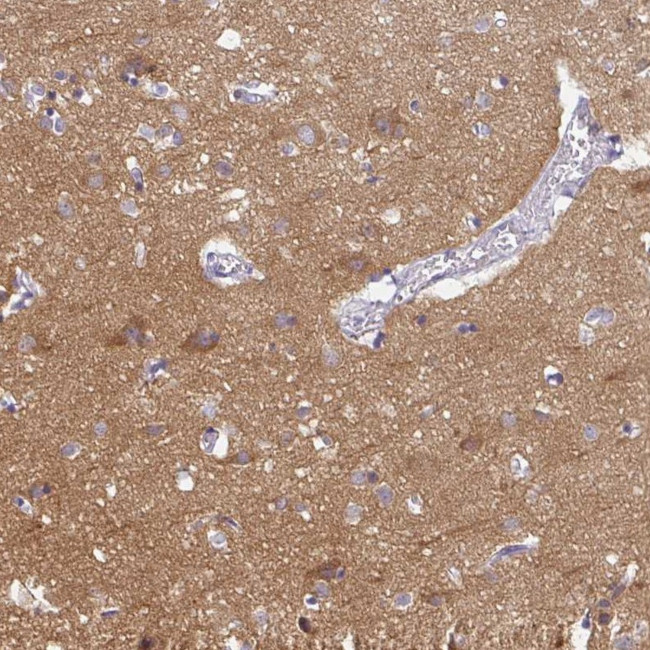 PPFIA4 Antibody in Immunohistochemistry (Paraffin) (IHC (P))
